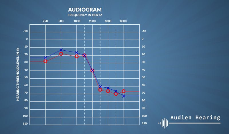 Will Audien Hearing Aids Work For Me?